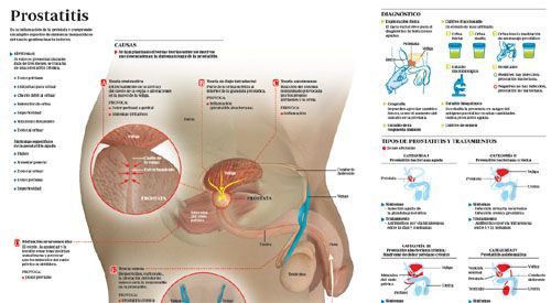 The causes of sexual disorders in prostatitis